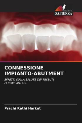 CONNESSIONE IMPIANTO-ABUTMENT