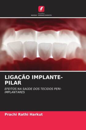 LIGAÇÃO IMPLANTE-PILAR