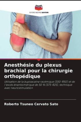 Anesthésie du plexus brachial pour la chirurgie orthopédique