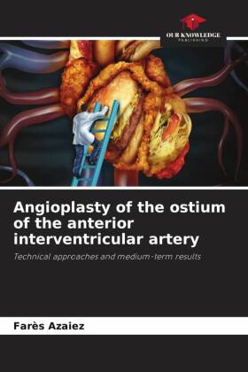 Angioplasty of the ostium of the anterior interventricular artery