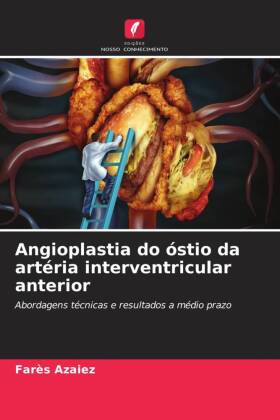 Angioplastia do óstio da artéria interventricular anterior