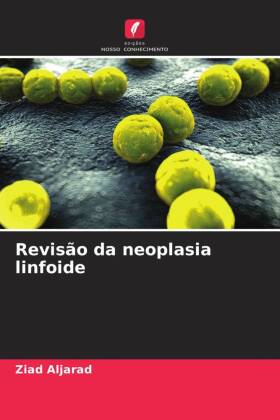 Revisão da neoplasia linfoide