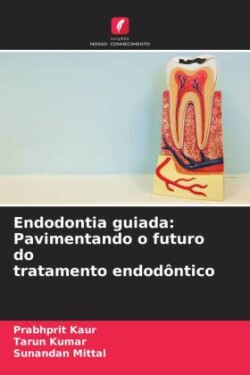 Endodontia guiada: Pavimentando o futuro do tratamento endodôntico