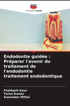 Endodontie guidée : Préparer l'avenir du traitement de l'endodontie traitement endodontique