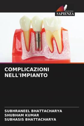 COMPLICAZIONI NELL'IMPIANTO