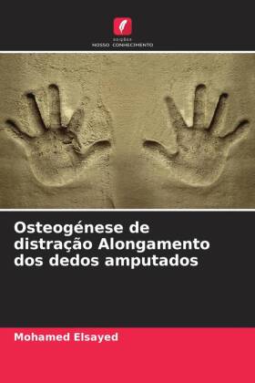 Osteogénese de distração Alongamento dos dedos amputados