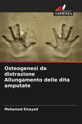 Osteogenesi da distrazione Allungamento delle dita amputate