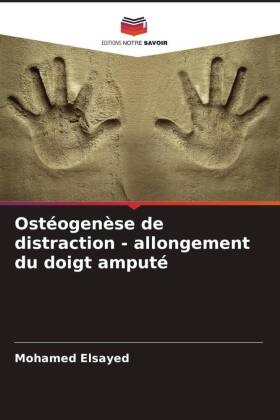 Ostéogenèse de distraction - allongement du doigt amputé