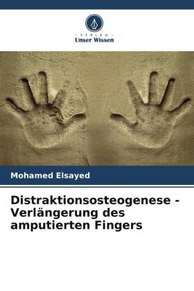 Distraktionsosteogenese - Verlängerung des amputierten Fingers