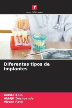 Diferentes tipos de implantes