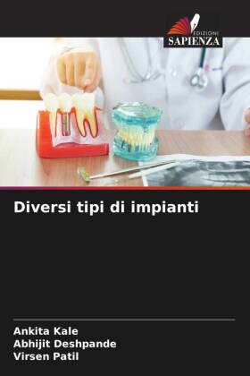 Diversi tipi di impianti