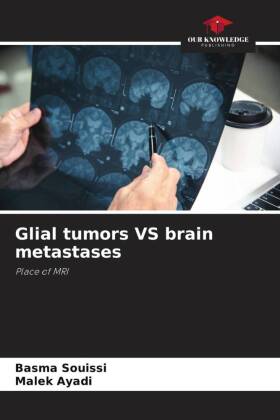 Glial tumors VS brain metastases