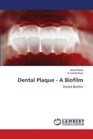 Dental Plaque - A Biofilm