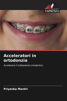 Acceleratori in ortodonzia