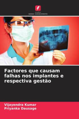 Factores que causam falhas nos implantes e respectiva gestão