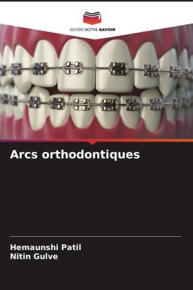 Arcs orthodontiques