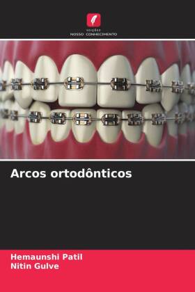 Arcos ortodônticos