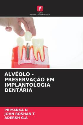 ALVÉOLO - PRESERVAÇÃO EM IMPLANTOLOGIA DENTÁRIA