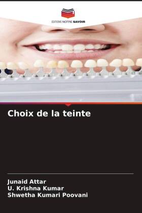 Choix de la teinte