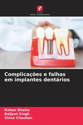 Complicações e falhas em implantes dentários