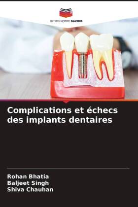 Complications et échecs des implants dentaires