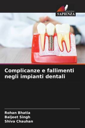 Complicanze e fallimenti negli impianti dentali