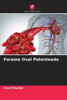 Forame Oval Patenteado