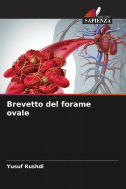 Brevetto del forame ovale