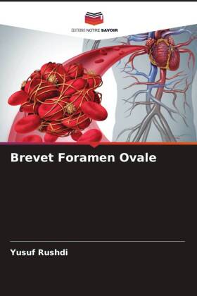 Brevet Foramen Ovale