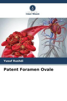 Patent Foramen Ovale