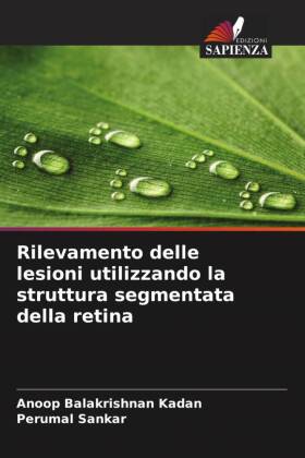 Rilevamento delle lesioni utilizzando la struttura segmentata della retina