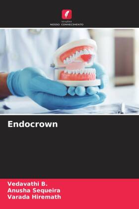 Endocrown