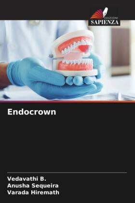 Endocrown