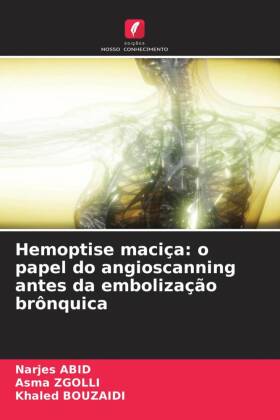 Hemoptise maciça: o papel do angioscanning antes da embolização brônquica