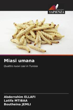 Miasi umana