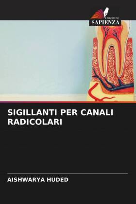 SIGILLANTI PER CANALI RADICOLARI