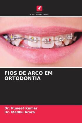 FIOS DE ARCO EM ORTODONTIA