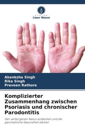 Komplizierter Zusammenhang zwischen Psoriasis und chronischer Parodontitis