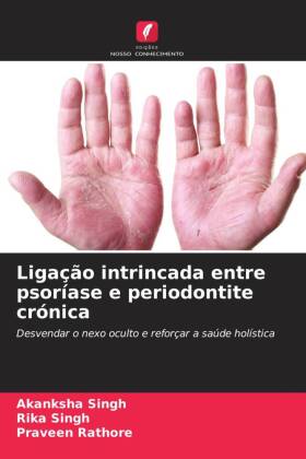 Ligação intrincada entre psoríase e periodontite crónica