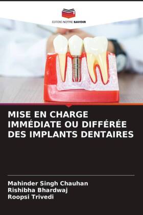 MISE EN CHARGE IMMÉDIATE OU DIFFÉRÉE DES IMPLANTS DENTAIRES