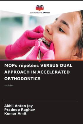 MOPs répétées VERSUS DUAL APPROACH IN ACCELERATED ORTHODONTICS