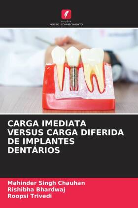 CARGA IMEDIATA VERSUS CARGA DIFERIDA DE IMPLANTES DENTÁRIOS