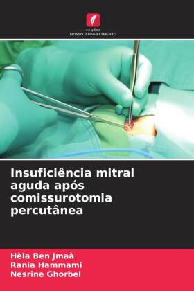 Insuficiência mitral aguda após comissurotomia percutânea