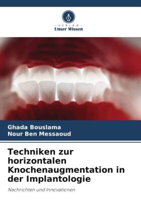 Techniken zur horizontalen Knochenaugmentation in der Implantologie