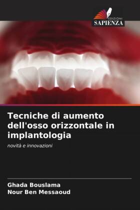 Tecniche di aumento dell'osso orizzontale in implantologia