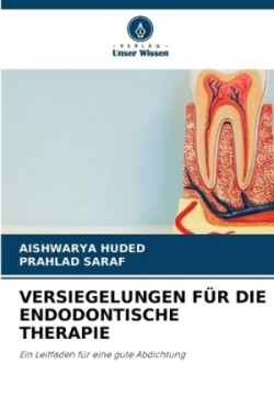 Versiegelungen Für Die Endodontische Therapie