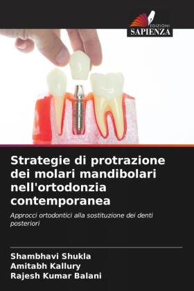 Strategie di protrazione dei molari mandibolari nell'ortodonzia contemporanea