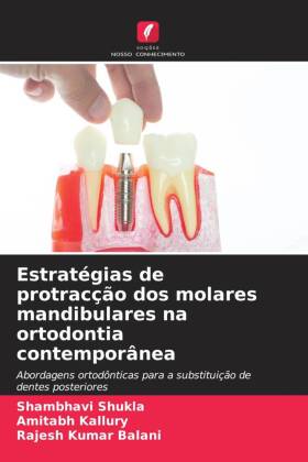 Estratégias de protracção dos molares mandibulares na ortodontia contemporânea