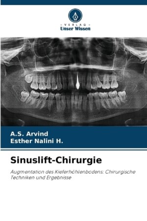 Sinuslift-Chirurgie