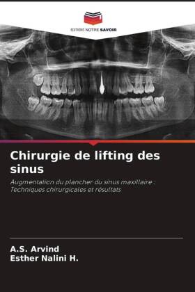 Chirurgie de lifting des sinus